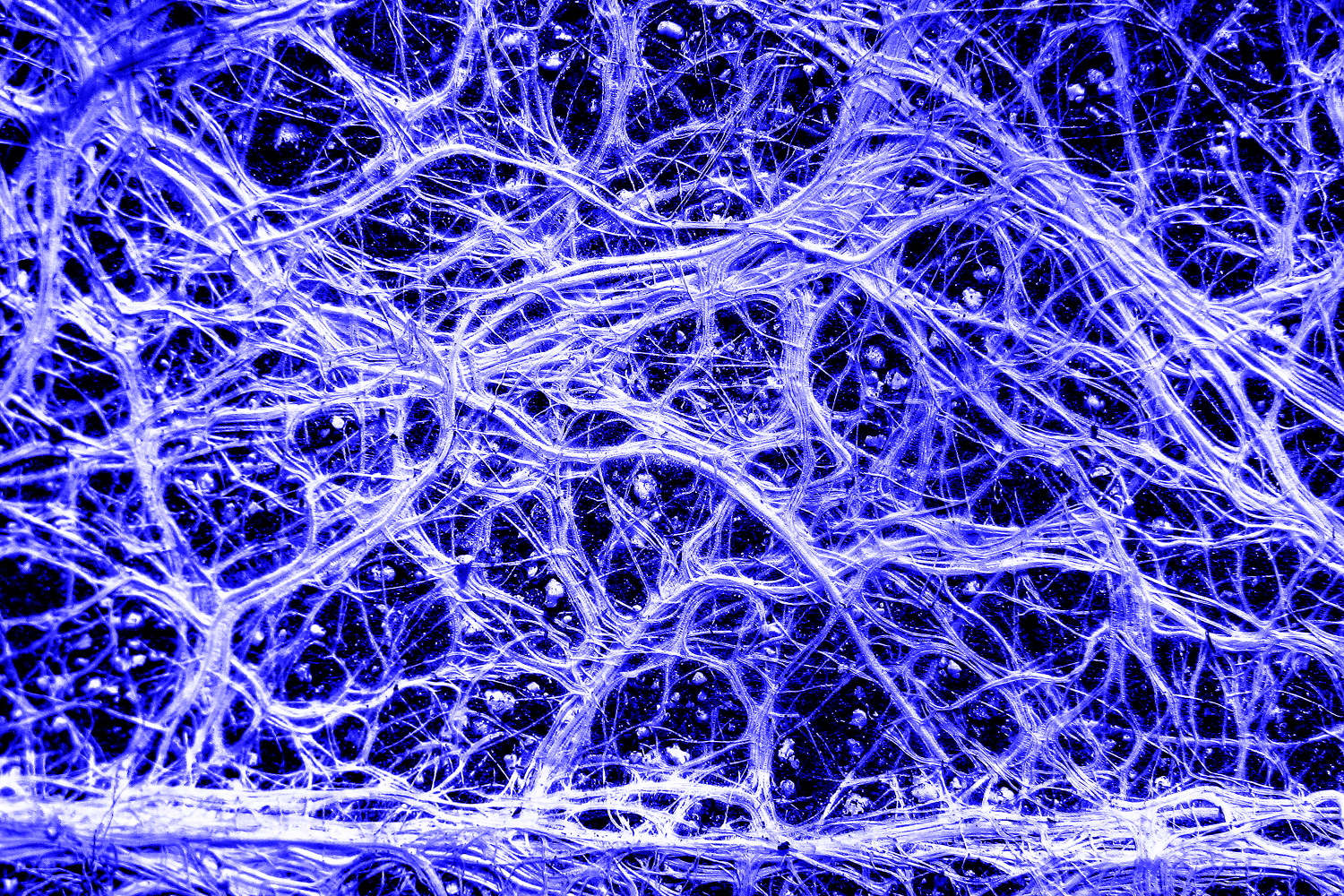 ncredible vascular plant fine roots looking like a neural network